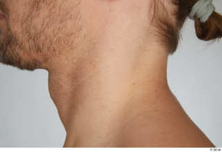 Erling neck 0003.jpg